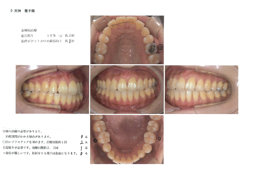 天神 雅 歯科・矯正歯科の治療計画